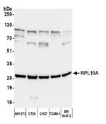 RPL10A/Ribosomal Protein L10a Antibody in Western Blot (WB)