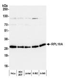 RPL10A/Ribosomal Protein L10a Polyclonal Antibody