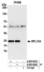 RPL10A/Ribosomal Protein L10a Antibody in Immunoprecipitation (IP)