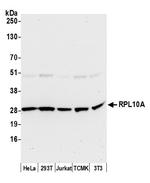RPL10A/Ribosomal Protein L10a Polyclonal Antibody