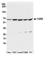 YARS/Tyrosyl-tRNA Synthetase/TYRRS Polyclonal Antibody