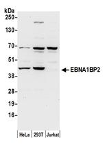 EBNA1BP2/EBNA1 Binding Protein 2/EBP2 Polyclonal Antibody