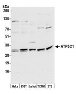ATP5C1/ATPG Polyclonal Antibody