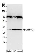 ATP5C1/ATPG Polyclonal Antibody