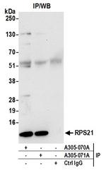 RPS21/Ribosomal Protein S21 Antibody in Immunoprecipitation (IP)