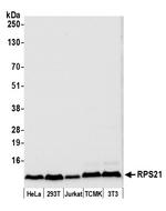 RPS21/Ribosomal Protein S21 Polyclonal Antibody