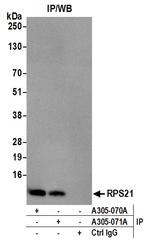 RPS21/Ribosomal Protein S21 Antibody in Immunoprecipitation (IP)