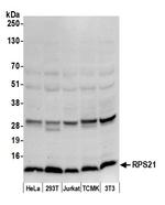 RPS21/Ribosomal Protein S21 Polyclonal Antibody