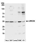 LRRC59 Polyclonal Antibody