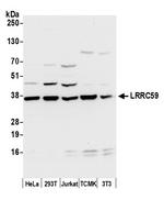 LRRC59 Polyclonal Antibody