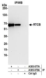 RTCB/C22orf28/FAAP Antibody in Immunoprecipitation (IP)