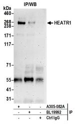 HEATR1/BAP28 Antibody in Immunoprecipitation (IP)