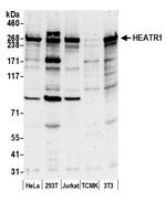 HEATR1/BAP28 Polyclonal Antibody