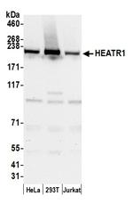 HEATR1/BAP28 Polyclonal Antibody