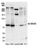SEC63 Polyclonal Antibody