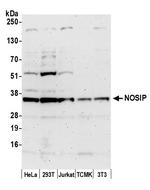 NOSIP Polyclonal Antibody