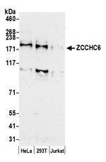 ZCCHC6 Polyclonal Antibody