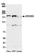 ZCCHC6 Polyclonal Antibody