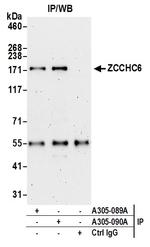 ZCCHC6 Polyclonal Antibody