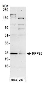 RPP25 Polyclonal Antibody