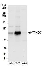 YTHDC1/YT521 Polyclonal Antibody