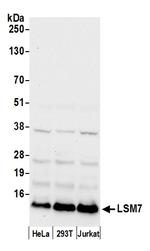 LSM7 Polyclonal Antibody
