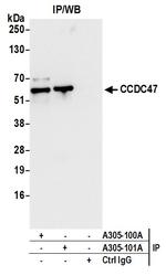 CCDC47 Antibody in Immunoprecipitation (IP)
