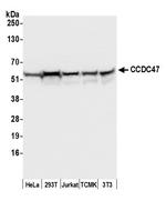 CCDC47 Polyclonal Antibody