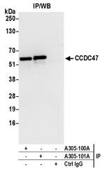 CCDC47 Antibody in Immunoprecipitation (IP)