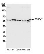 CCDC47 Polyclonal Antibody