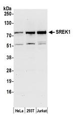 SREK1/SFRS12 Polyclonal Antibody