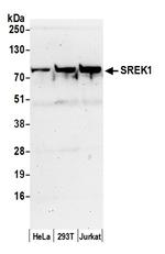 SREK1/SFRS12 Polyclonal Antibody