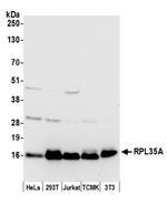 RPL35A/Ribosomal Protein L35a Polyclonal Antibody