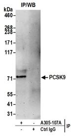 PCSK9 Polyclonal Antibody