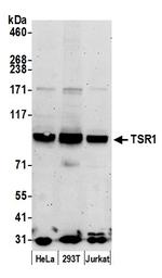 TSR1 Polyclonal Antibody