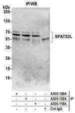 SPATS2L Antibody in Immunoprecipitation (IP)