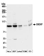 DIEXF/C1orf107 Polyclonal Antibody