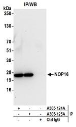 NOP16/HSPC111 Antibody in Immunoprecipitation (IP)