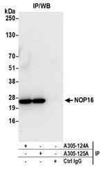 NOP16/HSPC111 Antibody in Immunoprecipitation (IP)