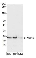 NOP16/HSPC111 Antibody in Western Blot (WB)