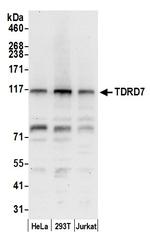 TDRD7 Polyclonal Antibody