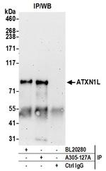 ATXN1L Polyclonal Antibody