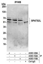 SPATS2L Polyclonal Antibody