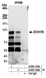 ZC3H7B Antibody in Immunoprecipitation (IP)