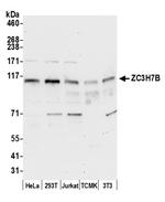 ZC3H7B Polyclonal Antibody