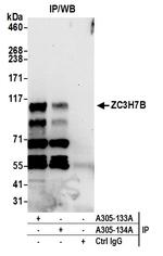 ZC3H7B Polyclonal Antibody
