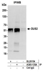 DUS2/DUS2L Antibody in Immunoprecipitation (IP)
