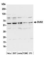 DUS2/DUS2L Polyclonal Antibody