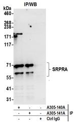 SRPRA/SRPR Antibody in Immunoprecipitation (IP)