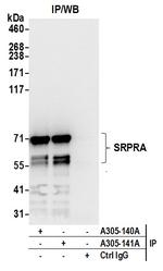 SRPRA/SRPR Antibody in Immunoprecipitation (IP)